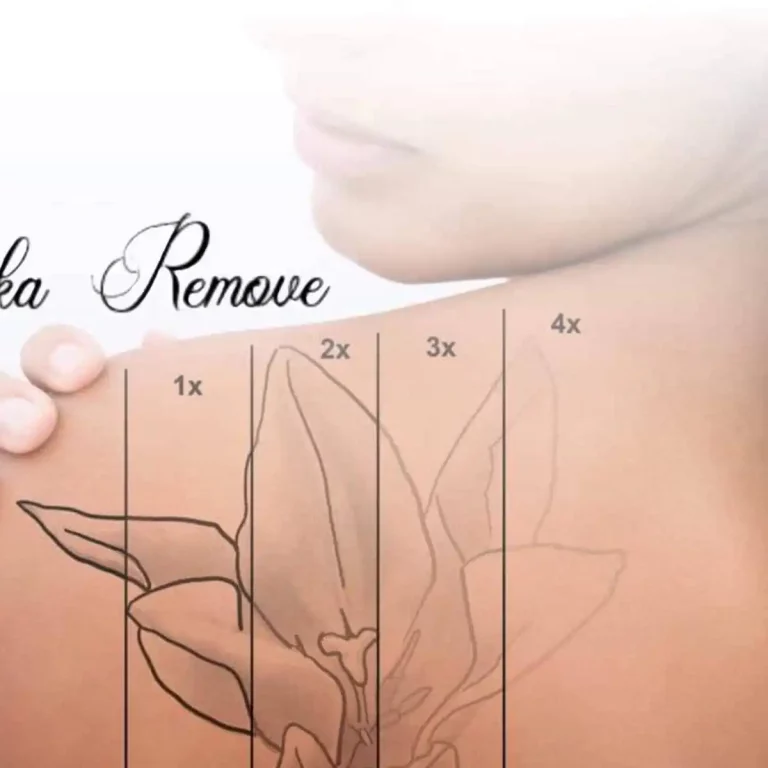 illustration_effacement_juka_remove